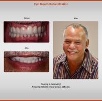 Siranli Implants & Facial Aesthetics image 12